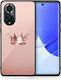 Smartfits Minimal Crown Back Cover din Plastic Roz (Huawei Nova 9 / Honor 50 5G / Honor 50)