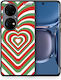 Smartfits Hearts Задна корица Розов (Huawei P50) A00_SM1-HU-P50PR_CHRISTMASHEARTS