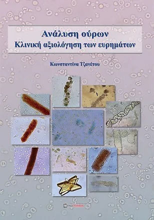 Ανάλυση Ούρων Ανάλυση Ούρων