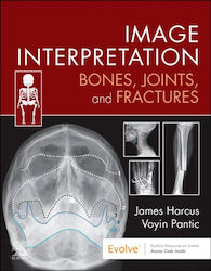 Image Interpretation: Bones, Joints, And Fractures