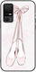 Ballet Shoes Silicone Multicolour (TCL 40 NXTPAPER 5G)