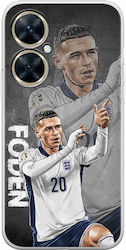 Euro 2024 Phil Foden Huawei Nova 11i Flexible Tpu Transparent Silicone