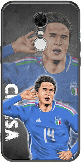Euro 2024 Federico Chiesa Xiaomi Redmi Note 4 Note 4x Black Tpu Μαύρη Σιλικόνη