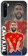 Euro 2024 Dani Carvajal Oneplus Nord Flexible Tpu Διάφανη Σιλικόνη