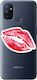 Oneplus Nord 100 Faint Kiss Transparent Silicone Tpu Θήκη