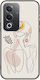 Pose Oppo A80 5g Schwarzes TPU Schwarzes Silikon