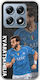 Football Stars Khvicha Kvaratskhelia Xiaomi 14t Pro 5g Flexible Tpu Διάφανη Σιλικόνη