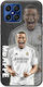Football Stars Kylian Mbappe Honor X8 Black TPU Black Silicone