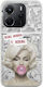 Normal Is Boring Xiaomi Redmi Note 14 4g Flexible Tpu Διάφανη Σιλικόνη