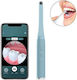 Endoscope Camera for Mobile