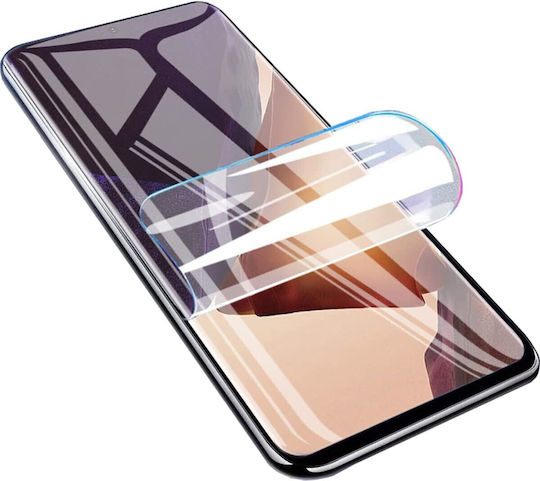 Infinity Enterprise Hydrogel Displayschutzfolie 3Stück (OnePlus 9)