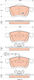 Trw Brake Pad Set Disc Brake Gdb1864