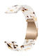 Watchband Hoco Wh19 Elegant Series Πλαστικό Μπρασελέ Samsung Huawei Xiaomi Vivo Oppo Κα 20mm Universal Nougat