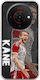 Football Stars Harry Kane Zte Blade A76 5g Silicon Transparent Flexibil TPU