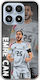 Euro 2024 Emre Can Xiaomi 17 5G Flexible TPU Durchsichtige Silikon Handyhülle