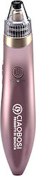 Avizar Wiederaufladbares Gesichtspflegegerät Mit Schwarze Flecken Entferner 4 Düsen Roségold Avizar Wiederaufladbares Gesichtspflegegerät Mit Schwarze Flecken Entferner 4 Düsen Roségold