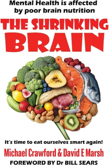 Shrinking Brain - Filament Publishing Ltd - Paperback / Softback Shrinking Brain - Filament Publishing Ltd - Paperback / Softback