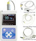 Contec CMS60D3 Επαγγελματικό Οξύμετρο Χειρός με 3 Αισθητήρες Δακτύλου Ενηλίκων, Παιδιών & Νεογνών για Παιδιά Λευκό