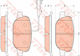 Trw Gdb1851 Brake Pad Set Disc Brake