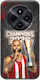 Kings Europe 2026 French Sniper Xiaomi Poco C75 4g Black TPU Black Silicone Case
