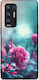 Sonique Case Sunset In Eden Series Oppo Find X3...