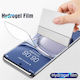 Sunshine Hydrogel Displayschutzfolie Für Moto G56
