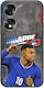 World Stars Collection Kylian Mbappe Honor 70 5g Black TPU Black Silicone Case