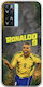 World Stars Collection Ronaldo Case Oppo A77 5g Flexible TPU Transparent Silicone