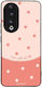 Sonique Delulu Polka Era Series Honor 90 5g Sti...