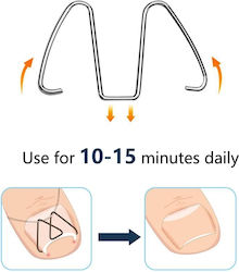 Set 6 Correctors 30 Elastic Bands Ingrown Nails Silver
