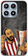 Kings Europe Legends Kill Bill Xiaomi 17 5g Flexible TPU Transparent Silicone Case