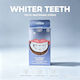 5 Days Teeth Whitening Treatment