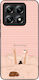 Sonique Stripe Stories Series Xiaomi Xiaomi 14t...