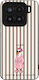 Sonique Stripe Stories Series Xiaomi Xiaomi 15 ...