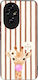 Θήκη Sonique Stripe Stories Series Honor 200 5g...