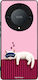 Sonique Case Stripe Stories Series Honor Magic5...