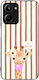 Sonique Hülle Stripe Stories Series Series Real...