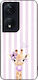 Θήκη Sonique Stripe Stories Series Honor 90 Sma...