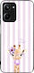 Sonique Hülle Stripe Stories Series Series Real...