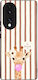 Калъф Sonique Stripe Stories Series Honor 70 5g...