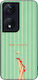 Θήκη Sonique Stripe Stories Series Honor 90 Sma...