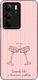 Sonique Stripe Stories Series Case Realme C75 4...