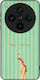 Sonique Stripe Stories Series Case Oppo Find X8...