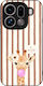 Sonique Stripe Stories Series Oppo Find X9 Pro ...