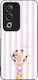 Калъф Sonique Stripe Stories Series Oppo A80 5G...