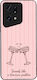 Sonique Stripe Stories Series Case Oppo Find X5...