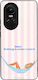 Sonique Stripe Stories Series Oppo Reno10 5g Ha...