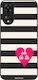 Sonique Stripe Stories Series Case Oppo A78 5g ...