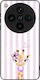 Sonique Stripe Stories Series Case Oppo Find X8...