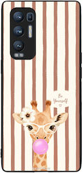 Θήκη Sonique Stripe Stories Series Oppo Find X3...